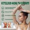 Vitíligo Aceite White Vitíligo Para 4×crema T