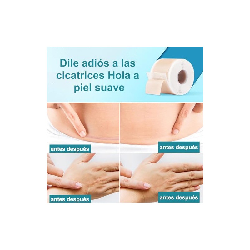 Cinta de Silicona Médica Avanzada para Eliminar Cicatrices, (Rollo de