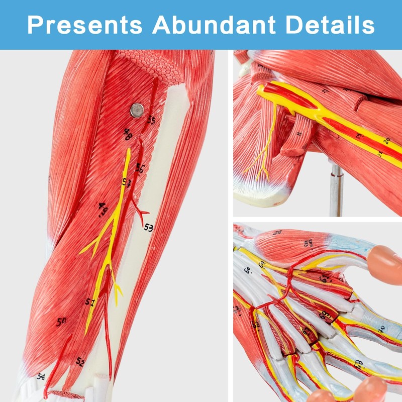 EVOTECH SCIENTIFIC Human Muscular Arm Anatomy Model, 7 Part 2/3