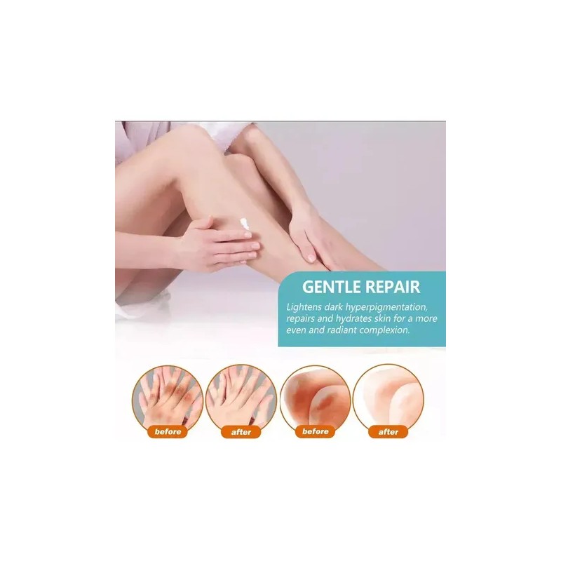Fixderma Nigrifix Crema Para Acantosis Nigricans Fbgx2