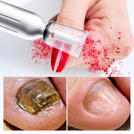 SOVI toenail care tool nail drill + dustproof cover charging tool storage base compatible wired + cordless, 1 set, silver / SOVI발톱 관리 도구 네일 드릴+방진 커버 충전 겸용 도구 수납 베이스 호환 유선 + 무선, 1세트, 실버
