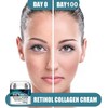 Anti Wrinkle Face Cream with 5% Acid, Collagen, 24hr Skincare,