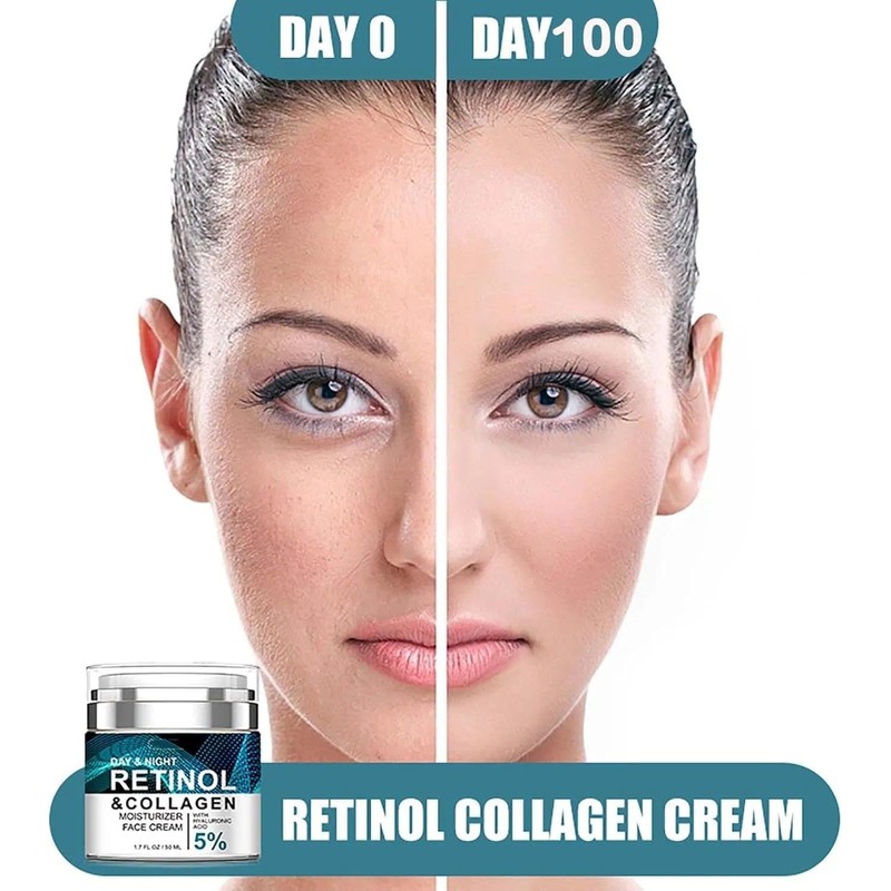 Anti Wrinkle Face Cream with 5% Acid, Collagen, 24hr Skincare,