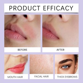 Sensitive Hair Removal Cream for Women - Gentle Facial & Upper Lip Hair Remover - Depilatory Cream with Shea Butter & Aloe Vera - Fast Acting in 5 Minutes, Painless Face Hair Remover Cream