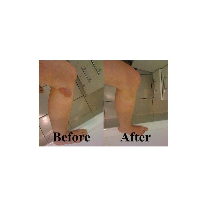 Hide Ink Temporary Tattoo Cover Up 4" x 6" -