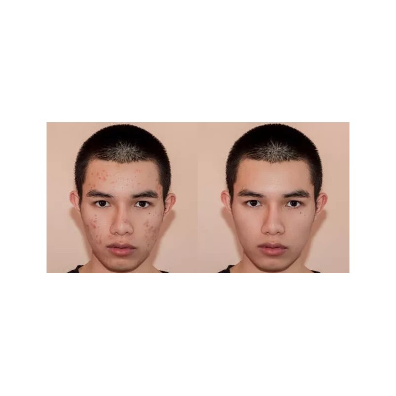 A3 Lemon Face Cream | Brightening & Control Stubborn Blemishes|400