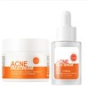 Acne removing essence,Anti-Aging Serum