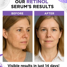 Perfect Look London Retinol Serum 0.25% – Anti-Ageing Night Face Serum for Fine Lines & Wrinkles – Hydrating Treatment with Hyaluronic Acid & Vitamin E – Gentle Formula for Sensitive Skin (30ml)