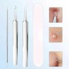 (3P) Sebum removal, extraction, extractor, blackheads, milia, needle, squeezing tool, face, eyes, nose / (3P) 피지 제거 압출 압출기 블랙헤드 비립종 바늘 짜는 도구 얼굴 눈 코