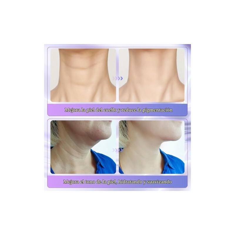 Crema Reafirmante de Cuello con Masaje de Rodillos 2 en