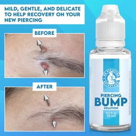 DR. PIERCING AFTERCARE DR. PIERCING AFTERCARE Keloid Drops C Non-Greasy Saline Solution for Keloid Bump Removal for Piercings - May Reduce Appearance of Nose Piercing Bump, Nose Ear Lip Belly (15 mL, 3-Pack)
