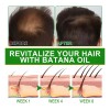 Aceite De Batana Para El Crecimiento Del Cabello - 118ml
