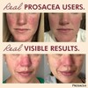 Prosacea - Heals Rosacea Symptoms of Redness, Pimples and Irritation