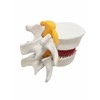 BoNew 1:1.5 Anatomical Human Lumbar Vertebrae Degenerative Lumbar Human Spine
