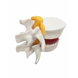BoNew 1:1.5 Anatomical Human Lumbar Vertebrae Degenerative Lumbar Human Spine Model White Color