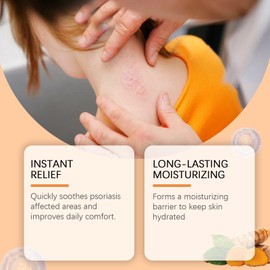 Befada Psoriasis Spray for Body, Hands & Feet - Soothe Redness itching and Other discomforts, Gentle Formula for Nourish The Skin, Suitable for Most Skin Types1FL.OZ