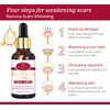 Aichun Beauty Scar Removal Serum Pimples Stretch Marks Face Whitening