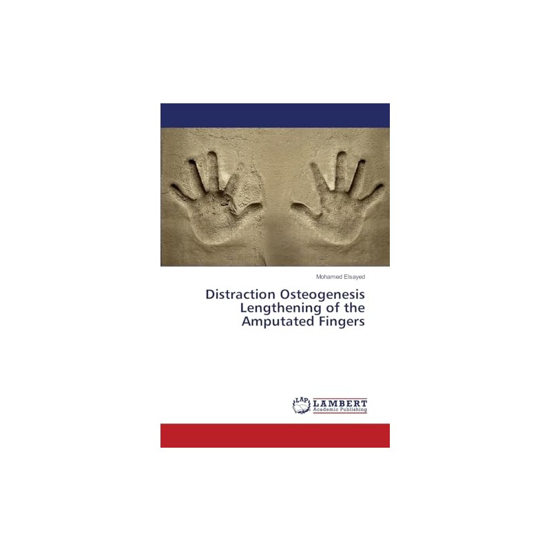 Distraction Osteogenesis Lengthening of the Amputated Fingers