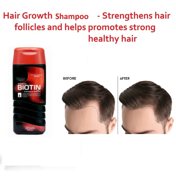 Crecimiento del Cabello Biotin Hair Regrowth Shampoo 355 ML Greasy Hair Cabello