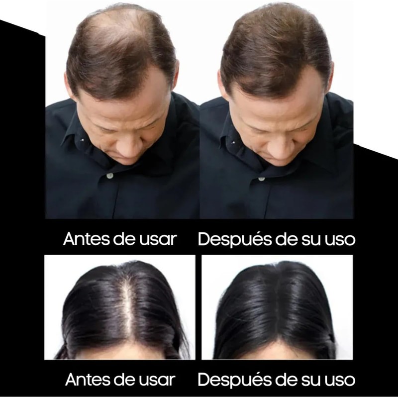 Repuesto para Frasco Sevich Fibras Capilares Naturales Adherentes Disimula Calvicie