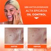 Darrow Actine Oil Control Gel Limpiador con Vitamina C, 400ml