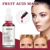AHA 30% + BHA 2% Peeling Solutions, Glycolic Acid Peel