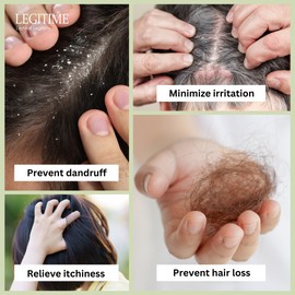 Legitime [KOREA] Legitime Scalp Air Tonic - Prevent Hair Loss