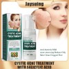 Jay Cystic Acne Tratamiento Para Eliminar Espinillas Barros Momento De