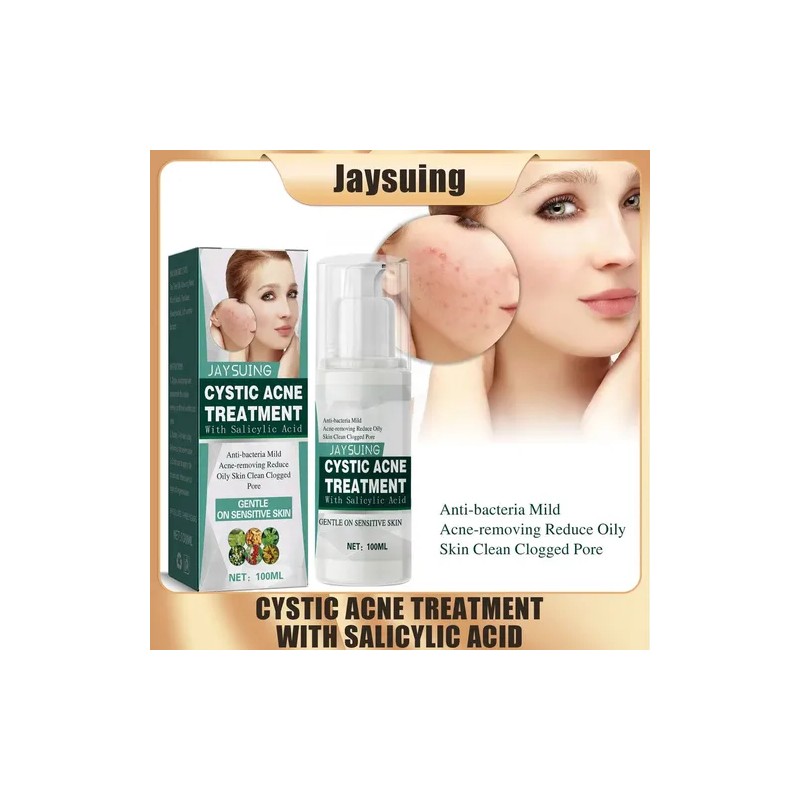 Jay Cystic Acne Tratamiento Para Eliminar Espinillas Barros Momento De