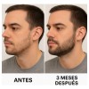 Tratamiento Para Crecer Barba Profesional Y Natural 55gr