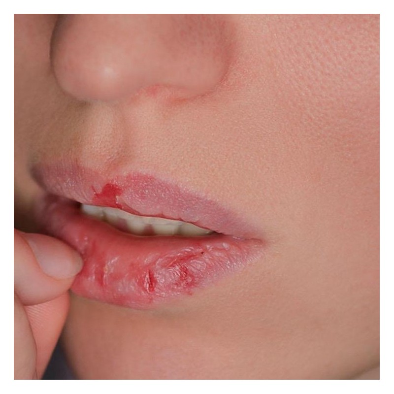 Squalane+amino acids lip balm