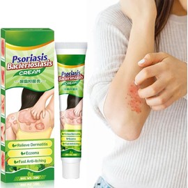 Crema Natural A Base De Hierbas Antipicazón, Crema Para Psoriasis Y Eczema, Cremas Hidratante Para Piel Seca, Con Picazón, Picaduras, Erupciones (paquete de 1)
