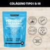 Péptidos Colágeno Hidrolizado Puro Tipo Iii Días Certificado 100 Pastoreo