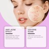 Ouhoecrema Facial Cuidado Acné Ácido Azelaic