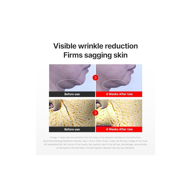 Centellian24 Madeca Cream Time Reverse