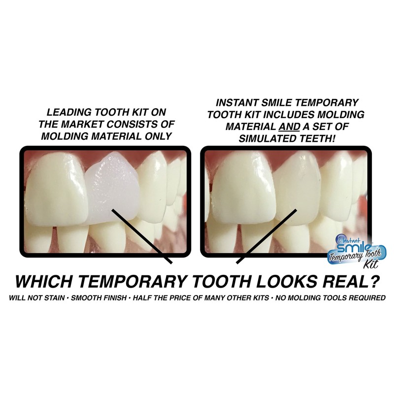 Instant Smile MULTISHADE Patented Temporary Tooth Repair Kit. A Realistic