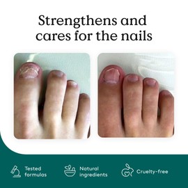 HealthRoutine Health Routine Nail Care Pen Set of 5 C The Original Cosmetic Care for Nail Fungal Infection Quick & Effective for Nourished Fingernails & Toenails with Tea Tree Oil, Vitamin E & Aloe Vera