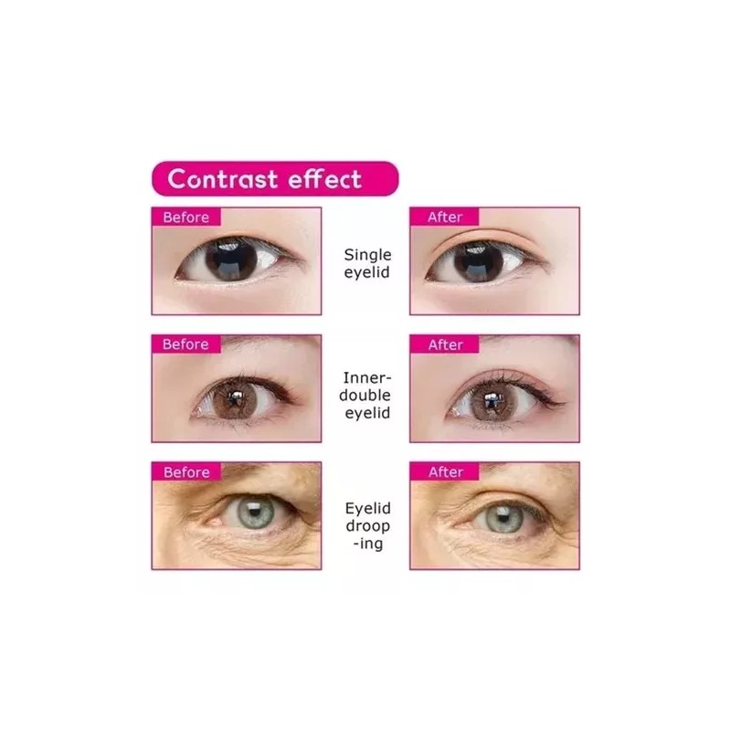 Meiso Parche Invisible Con Cinta Elevadora De Párpados Doble, 2400