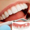 Generic,dientes postizos,blanqueador de dientes Paquete De 7 Pares Falsos Profesionales