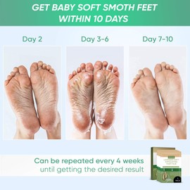Foot Peel Mask 3 Pack, For Cracked Heels Exfoliating Film, Peeling Away Calluses and Dead Skin Cells, Make Your Feet Baby Soft, Repair Rough Heels, Get Silky Soft Natural Treatment by MASHELE (Lavender, 3 Pack)