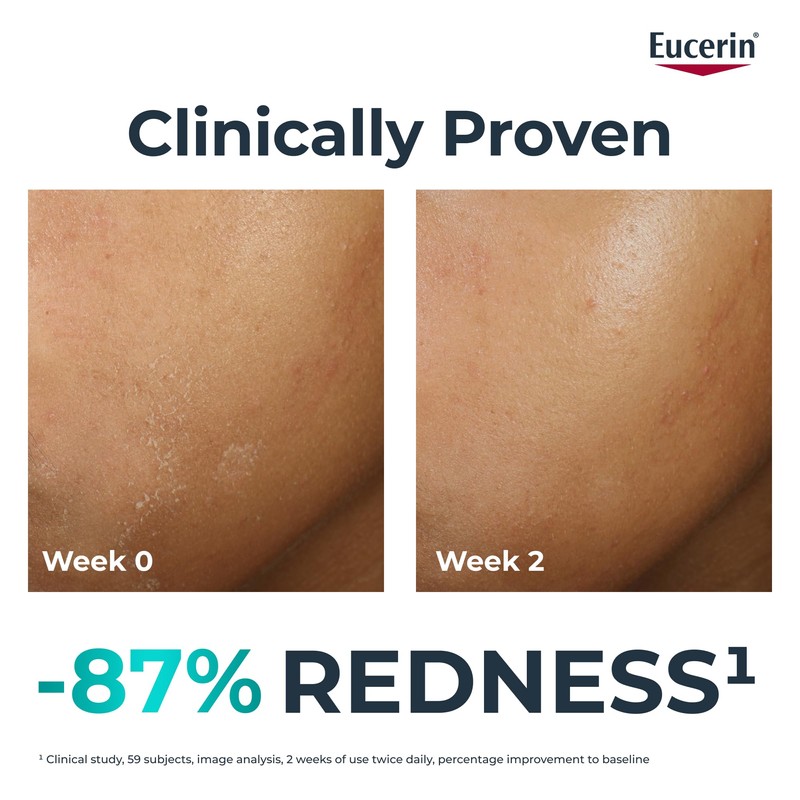 Eucerin Dermopure Clinical Hydra Repair Fluid 40ml, Moisturising Repair Cream