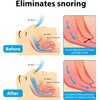 Sleep Nose Clip and Anti-Snoring Sleep Nose Clip Set, 4