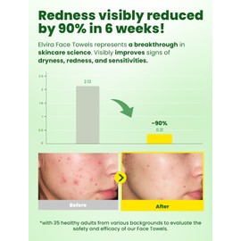 Elvira 100 Count Disposable Face Towels, Biodegradable Facial Cleansing Towels, Ultra Soft & Thick Cloth for Sensitive Skin, Makeup Remover Dry Wipes, Lint-Free Towelettes for Cleansing