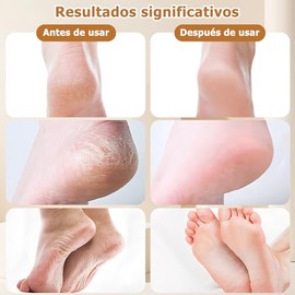 Removedor de Callos Eléctrico para Pies, Lima para Pies, 3 Velocidades, 2 Rodillos,Impermeable IPX7, Lima de Pies, Kit de Pedicura Profesional para Cu