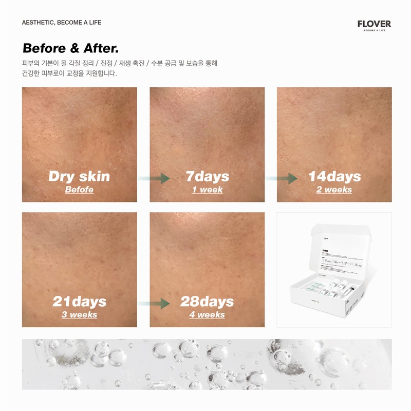 Hickstein 🎁Tool🎁 Hickstein Skin Correction Ampoule (Heextein) 28days Hickstein Skin