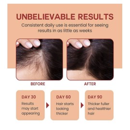 Leb Organic Batana Oil For Hair Growth 4oz, Scalp Mask For Strong Hair Regrowth