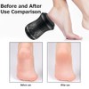 Electric Callus Remover Electric Foot Grinder Foot Files Clean Tools