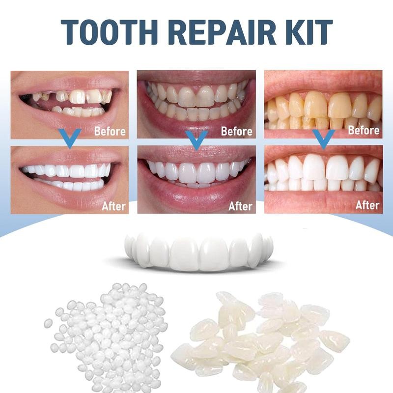 JAYSUING [JAYSUING]Shapeable Denture Pellets, Moldable False Teeth, Shapeable Teeth Cover,