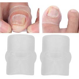 Ingrown Nail Corrector, 2Pcs Silicone Ingrown Toenail Correcting Tool Ingrown Nail Corrector Ingrown Toenail Corrector Paronychia Treatment for Ingrown Toenail