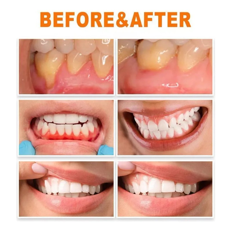 14 Piezas Gel De Cuidado Gingival 1.5ml